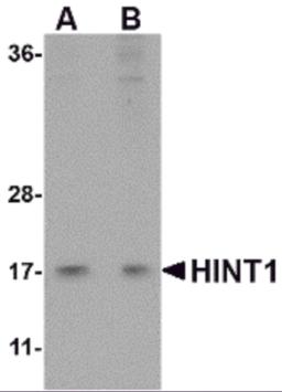 Western blot analysis of HINT1 in Jurkat lysate with HINT1 antibody at (A) 1 and (B) 2 &#956;g/mL.