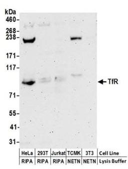 Detection of human TfR by western blot.