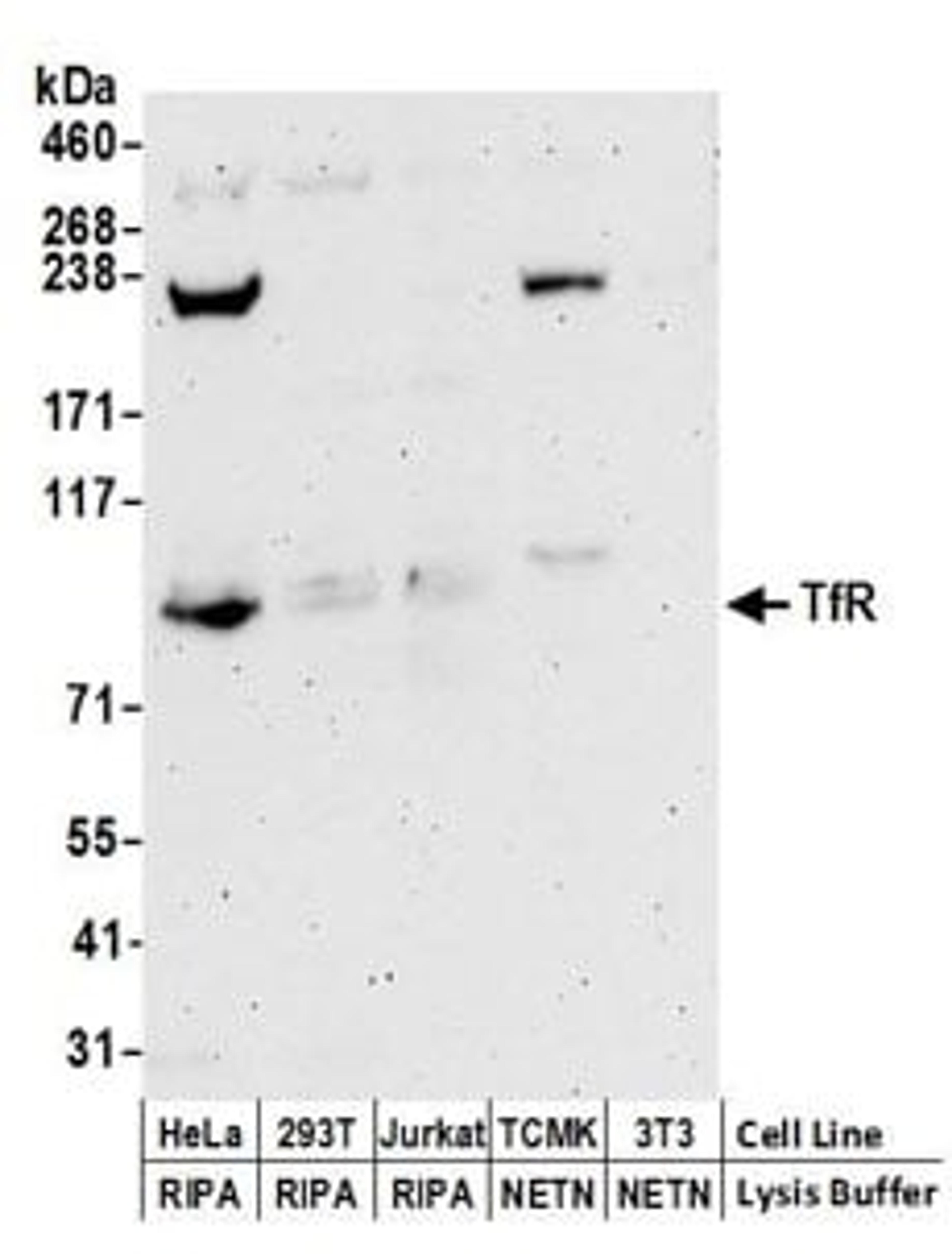 Detection of human TfR by western blot.