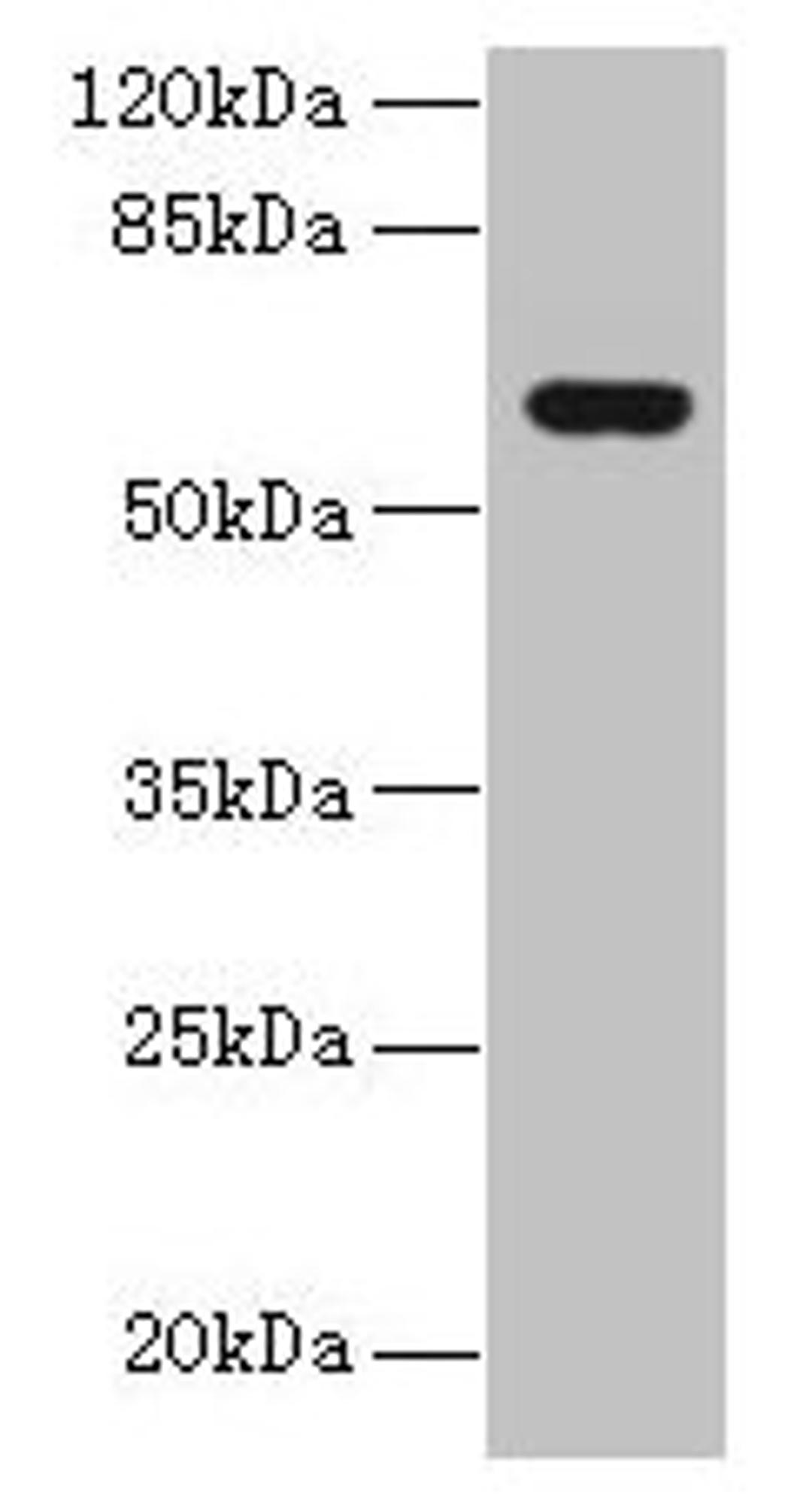 Western blot. All lanes: KATNAL2 antibody at 1µg/ml + U251 whole cell lysate. Secondary. Goat polyclonal to rabbit IgG at 1/10000 dilution. Predicted band size: 62, 53 kDa. Observed band size: 62 kDa