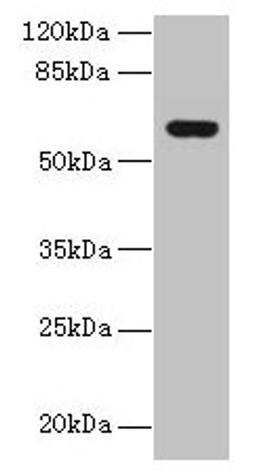 Western blot. All lanes: KATNAL2 antibody at 1µg/ml + U251 whole cell lysate. Secondary. Goat polyclonal to rabbit IgG at 1/10000 dilution. Predicted band size: 62, 53 kDa. Observed band size: 62 kDa