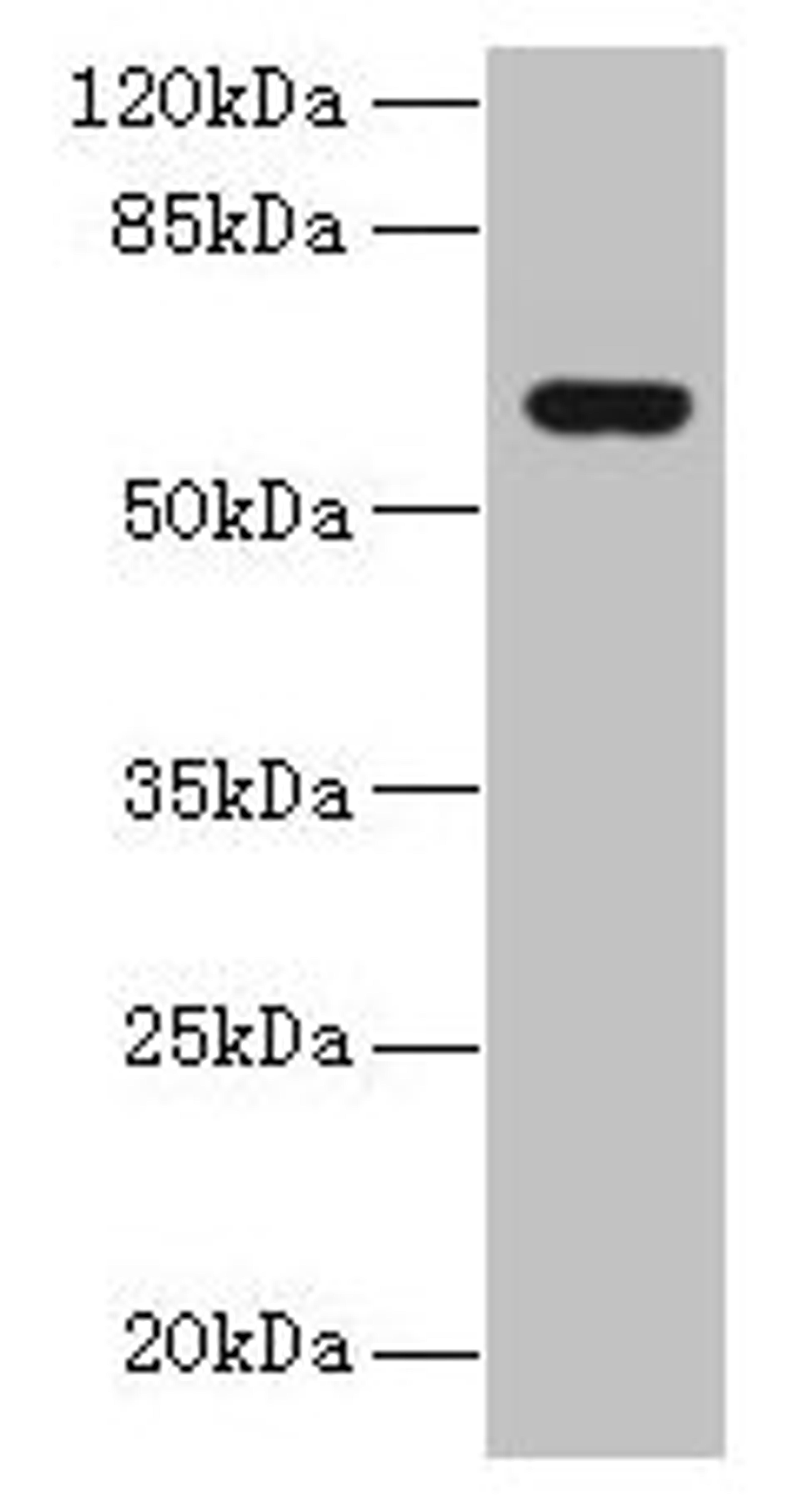 Western blot. All lanes: KATNAL2 antibody at 1µg/ml + U251 whole cell lysate. Secondary. Goat polyclonal to rabbit IgG at 1/10000 dilution. Predicted band size: 62, 53 kDa. Observed band size: 62 kDa