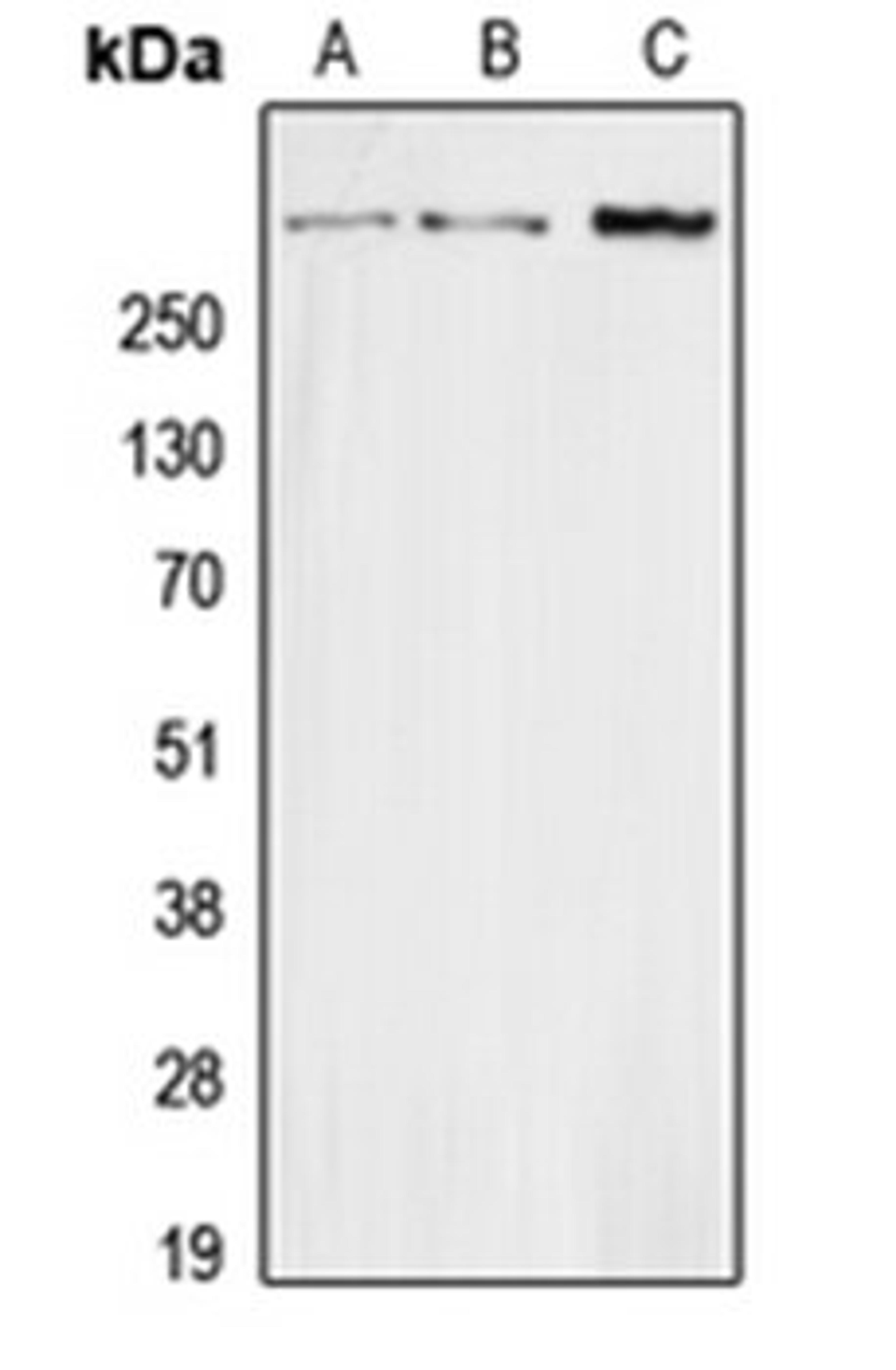 Western blot analysis of HEK293T (Lane 1), Raw264.7 (Lane 2), H9C2 (Lane 3) whole cell lysates using SCT antibody