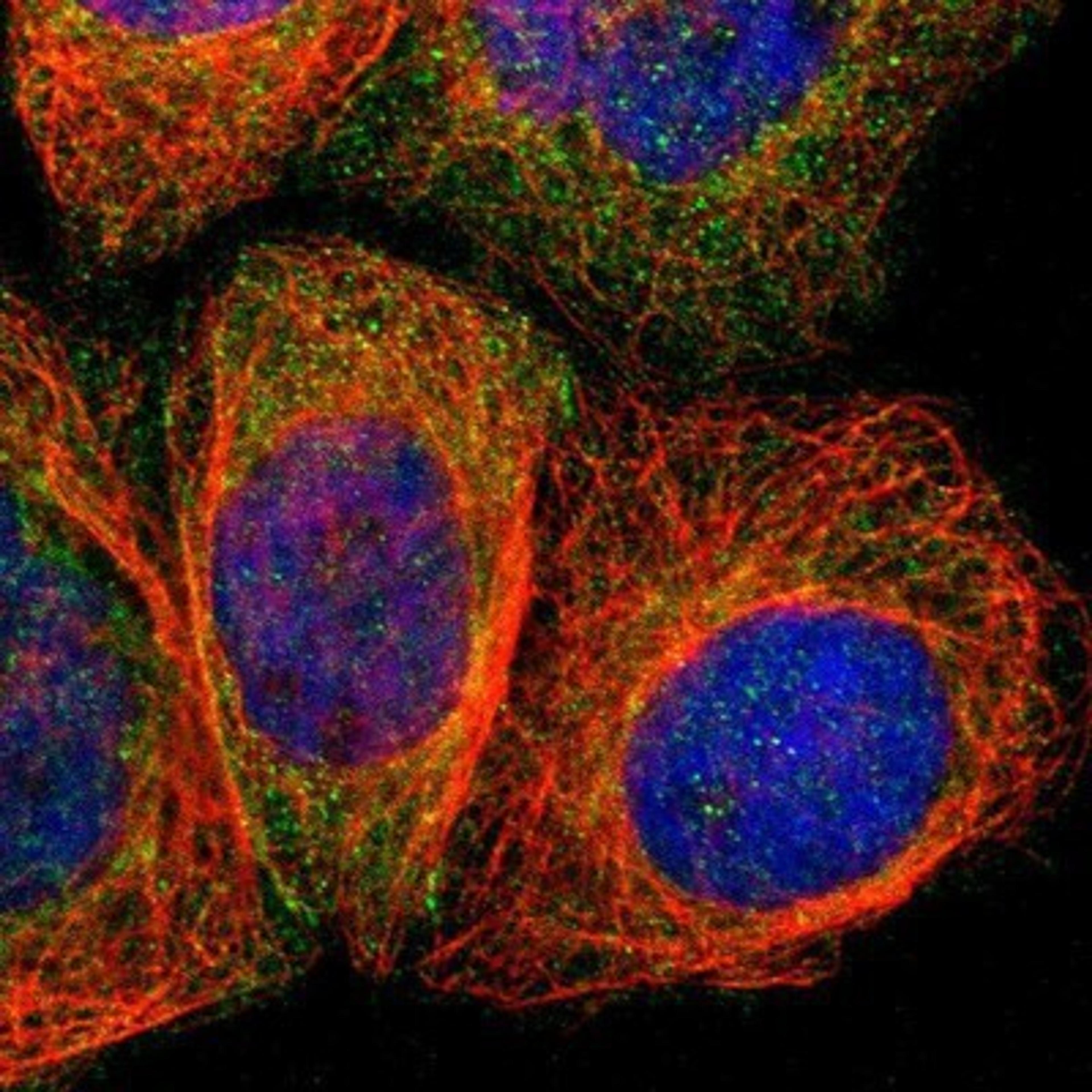 Immunocytochemistry/Immunofluorescence: Angiomotin like 1 Antibody [NBP1-91665] - Staining of human cell line A-431 shows positivity in cytoplasm & cell junctions.