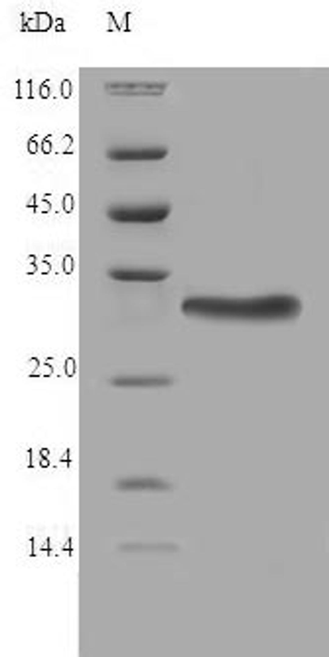 (Tris-Glycine gel) Discontinuous SDS-PAGE (reduced) with 5% enrichment gel and 15% separation gel.