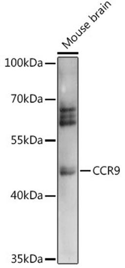 Western blot - CCR9 antibody (A14848)