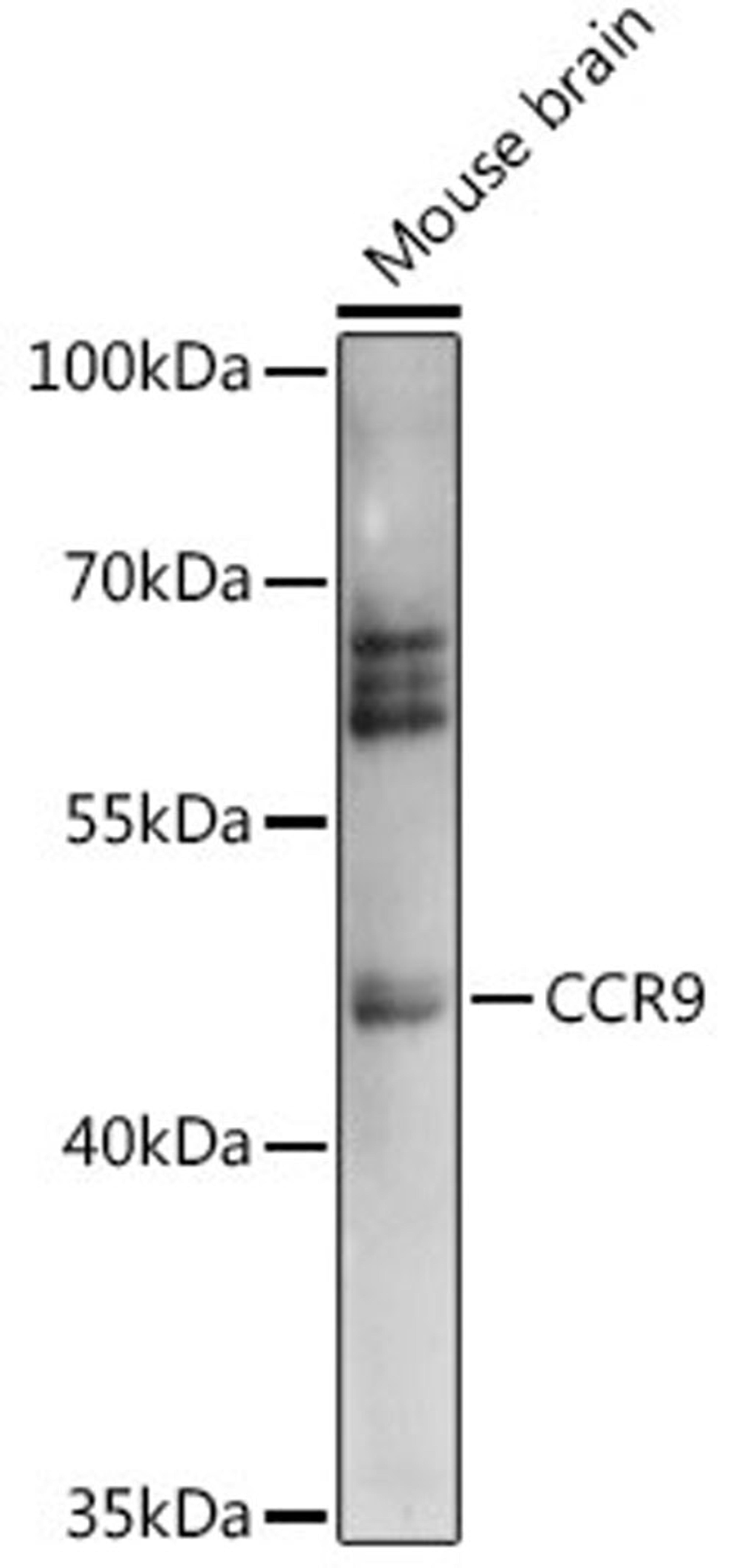 Western blot - CCR9 antibody (A14848)