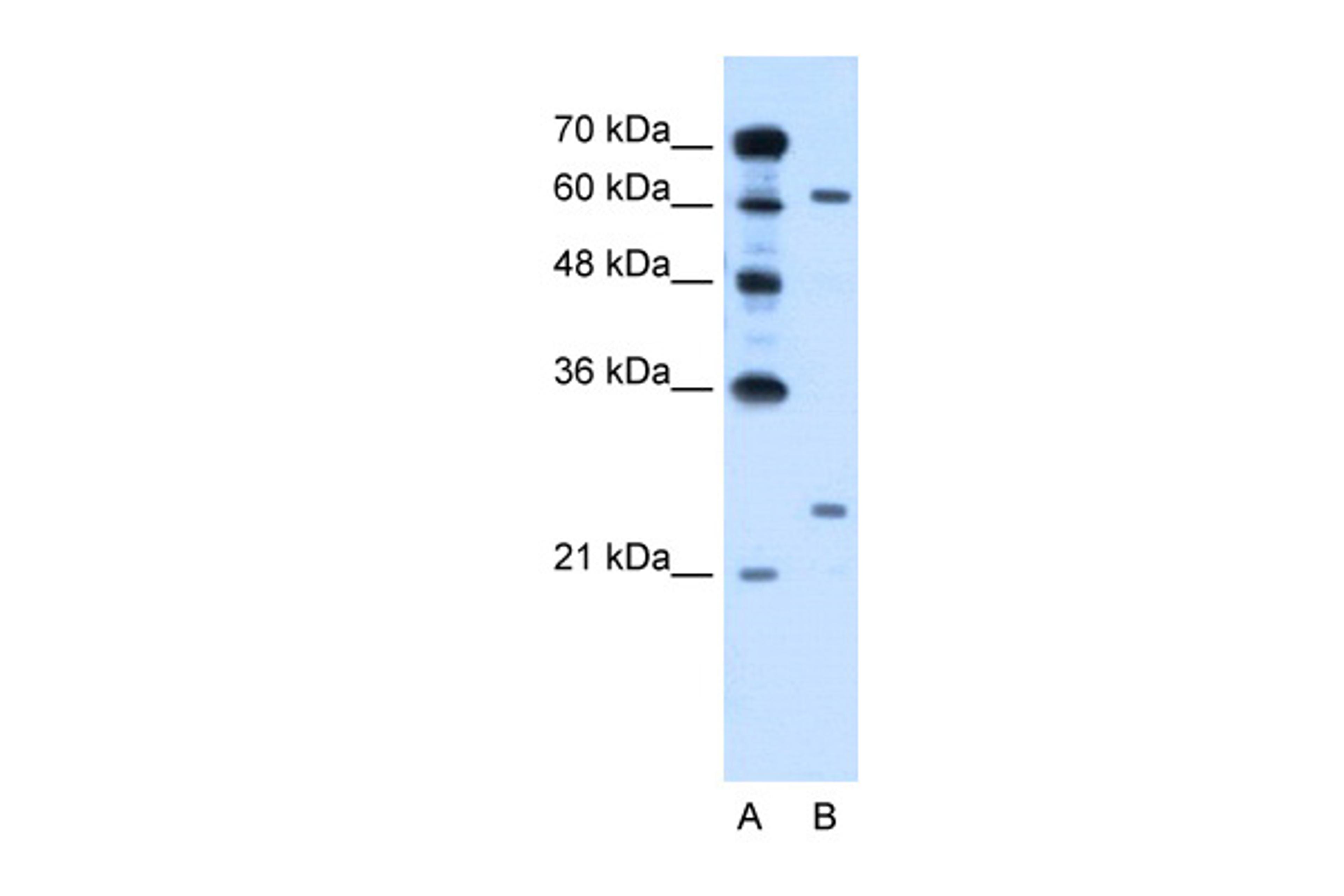 Antibody used in WB on Human HepG2 at 0.2-1 ug/ml.