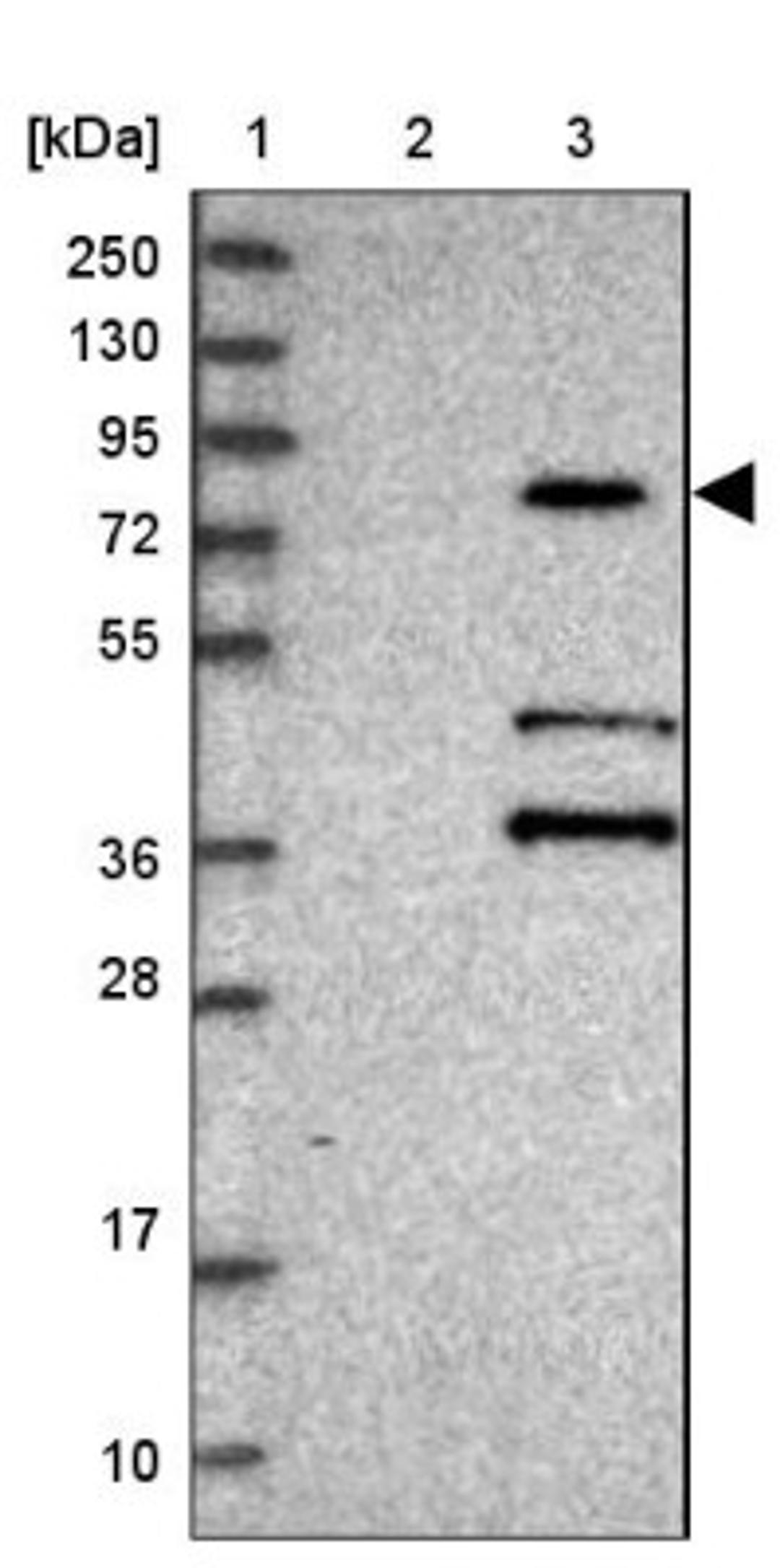 Western Blot: KBTBD7 Antibody [NBP1-92040] - Lane 1: Marker [kDa] 250, 130, 95, 72, 55, 36, 28, 17, 10<br/>Lane 2: Human cell line RT-4<br/>Lane 3: Human cell line U-251MG sp