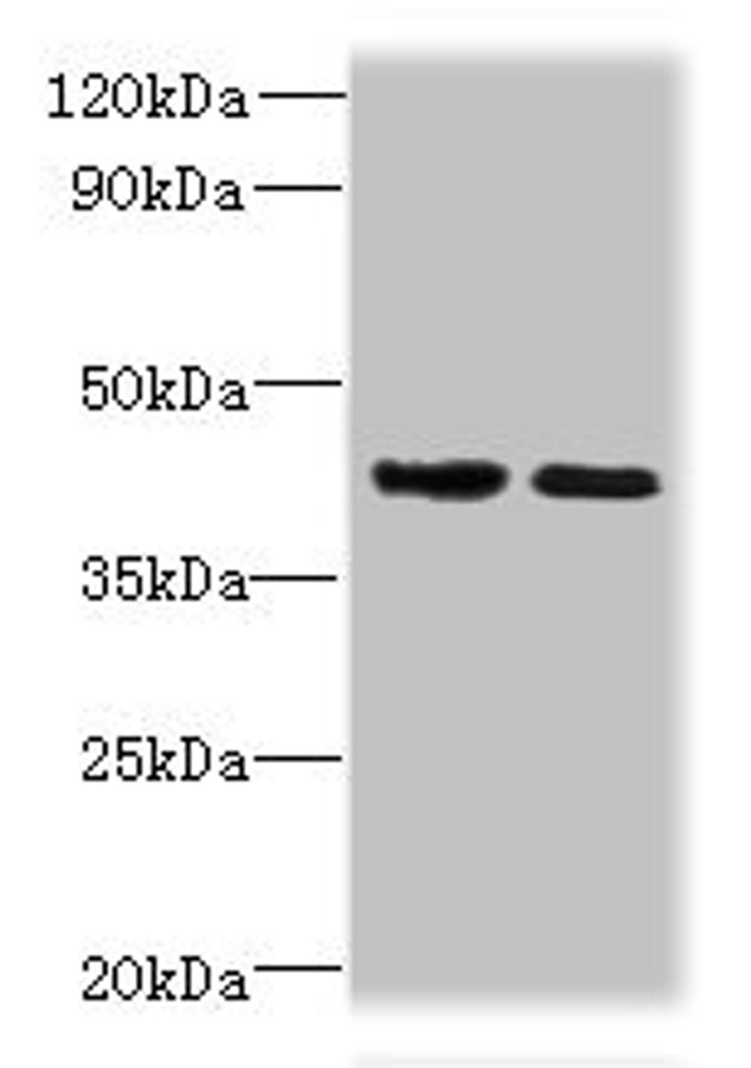 Western blot. All lanes: CHID1 antibody at 0.2ug/ml. Lane 1: Hela whole cell lysate. Lane 2: U251 whole cell lysate. Secondary. Goat polyclonal to rabbit IgG at 1/10000 dilution. Predicted band size: 45, 48, 42 kDa. Observed band size: 45 kDa. 