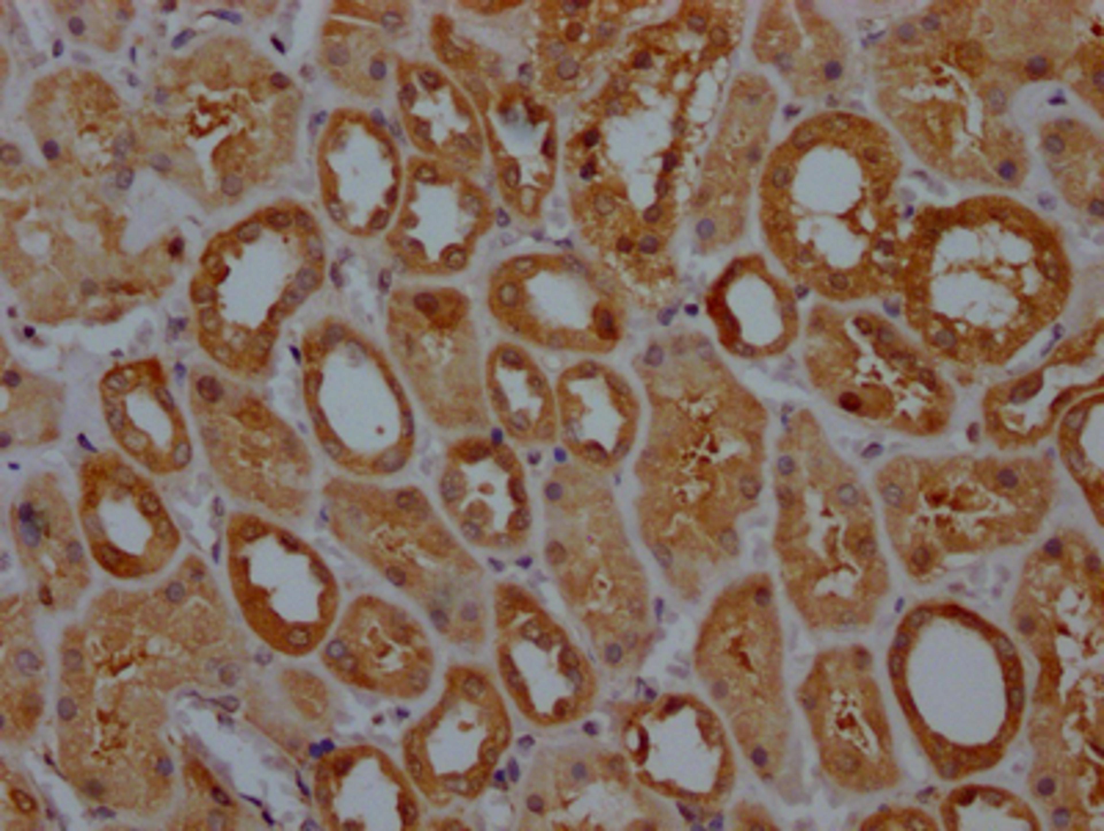 IHC image of CSB-RA188594A0HU diluted at 1:100 and staining in paraffin-embedded human kidney tissue performed on a Leica BondTM system. After dewaxing and hydration, antigen retrieval was mediated by high pressure in a citrate buffer (pH 6.0). Section was blocked with 10% normal goat serum 30min at RT. Then primary antibody (1% BSA) was incubated at 4℃ overnight. The primary is detected by a Goat anti-rabbit IgG polymer labeled by HRP and visualized using 0.05% DAB.
