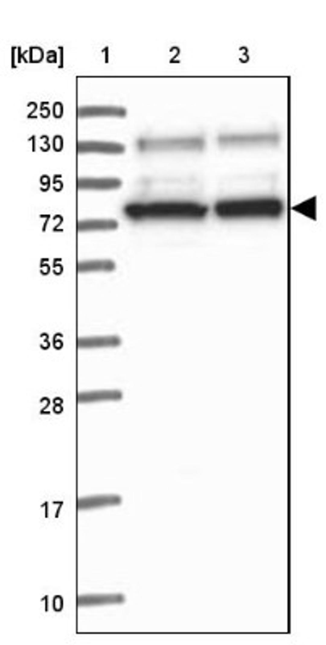 Western Blot: SAPS3 Antibody [NBP2-34049] - Lane 1: Marker [kDa] 250, 130, 95, 72, 55, 36, 28, 17, 10<br/>Lane 2: Human cell line RT-4<br/>Lane 3: Human cell line U-251MG sp