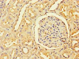 Immunohistochemistry of paraffin-embedded human kidney tissue using CSB-PA865137LA01HU at dilution of 1:100