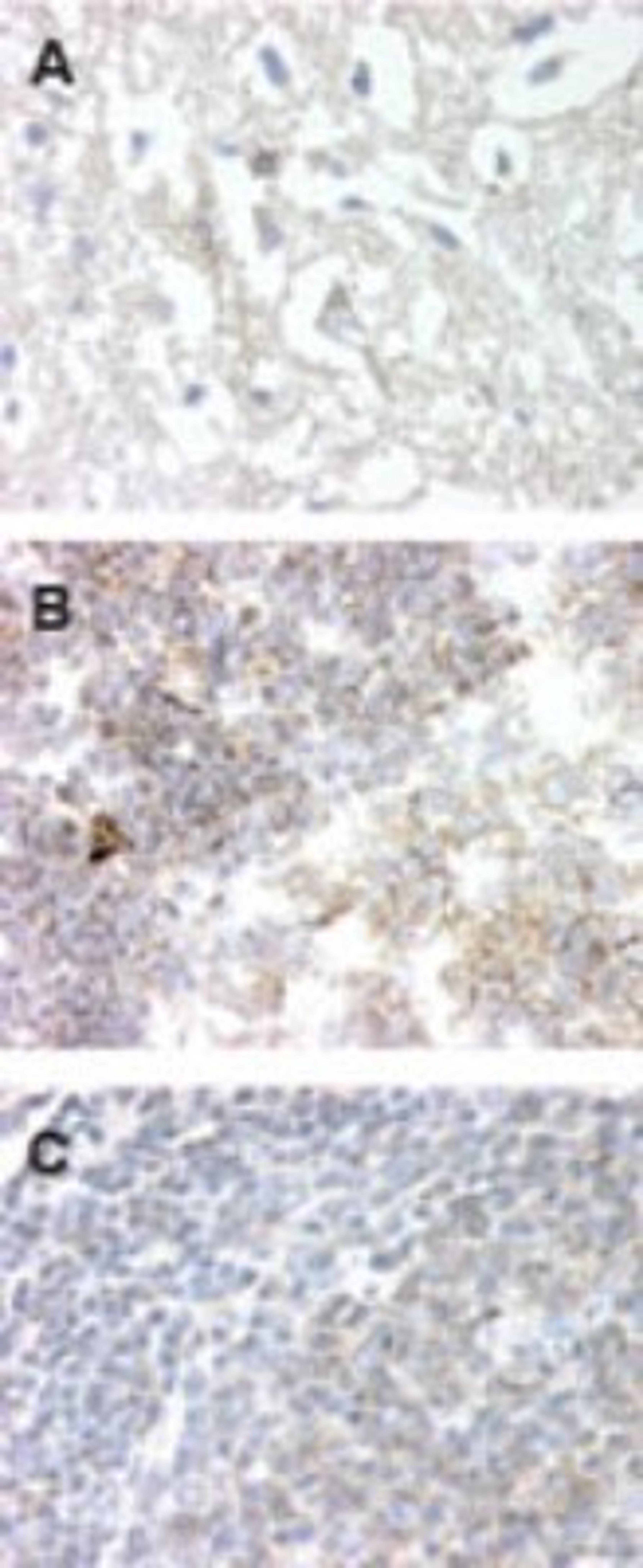 Immunohistochemistry-Paraffin: GPR83 Antibody [NBP2-24515] - Analysis of frozen brain (neurons & glia, image A), frozen tonsil tissue (lymphocytes, image B), and formalin-fixed paraffin embedded tonsil tissue using GPR83 antibody at 20 ug/ml.