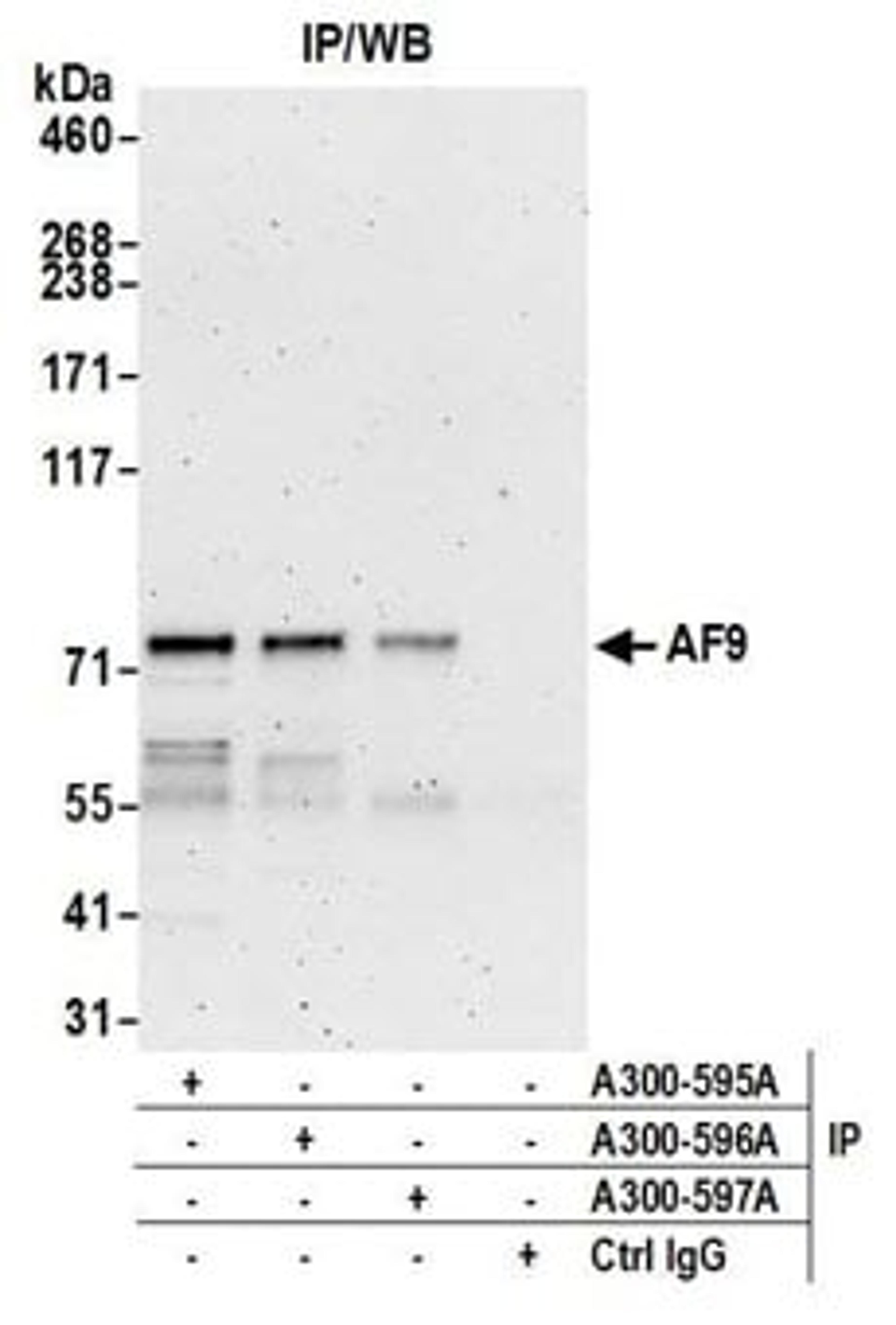 Detection of Human AF9 by Western Blot of Immunoprecipitates.