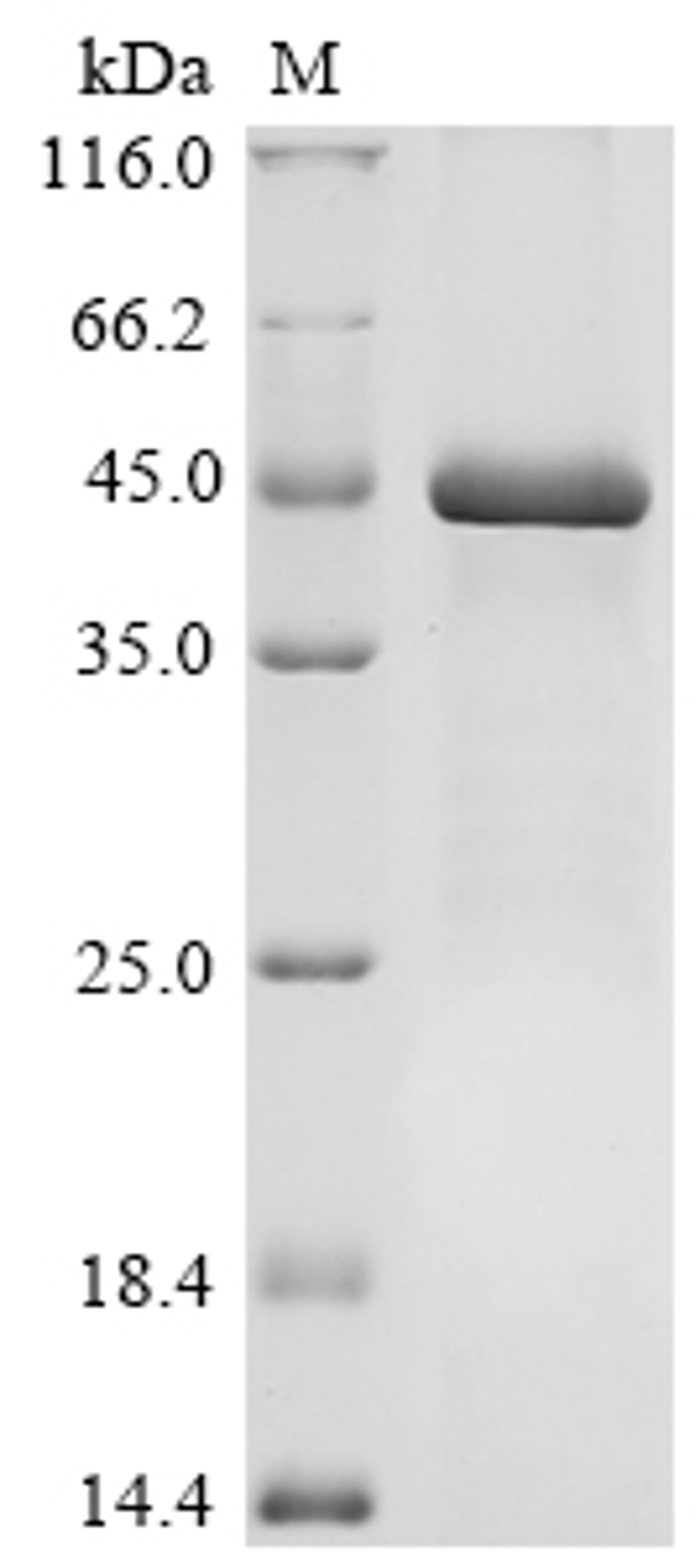 (Tris-Glycine gel) Discontinuous SDS-PAGE (reduced) with 5% enrichment gel and 15% separation gel.