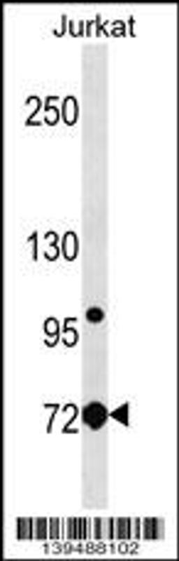 Western blot analysis in Jurkat cell line lysates (35ug/lane).