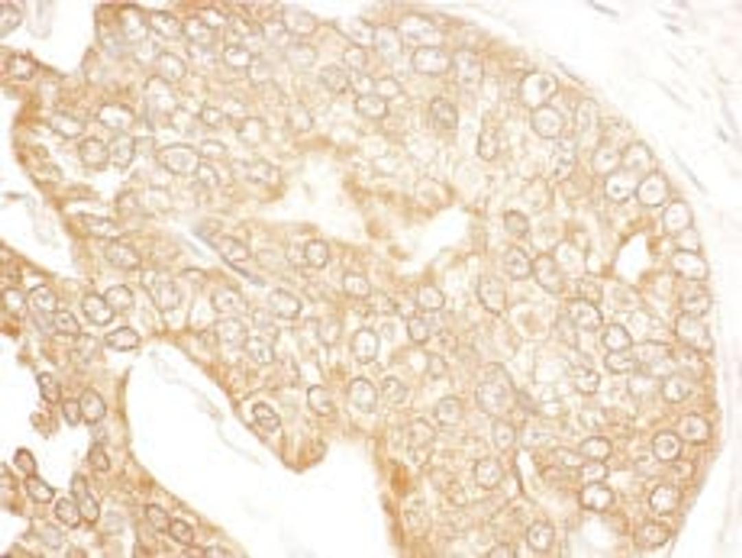 Detection of human p600 by immunohistochemistry.