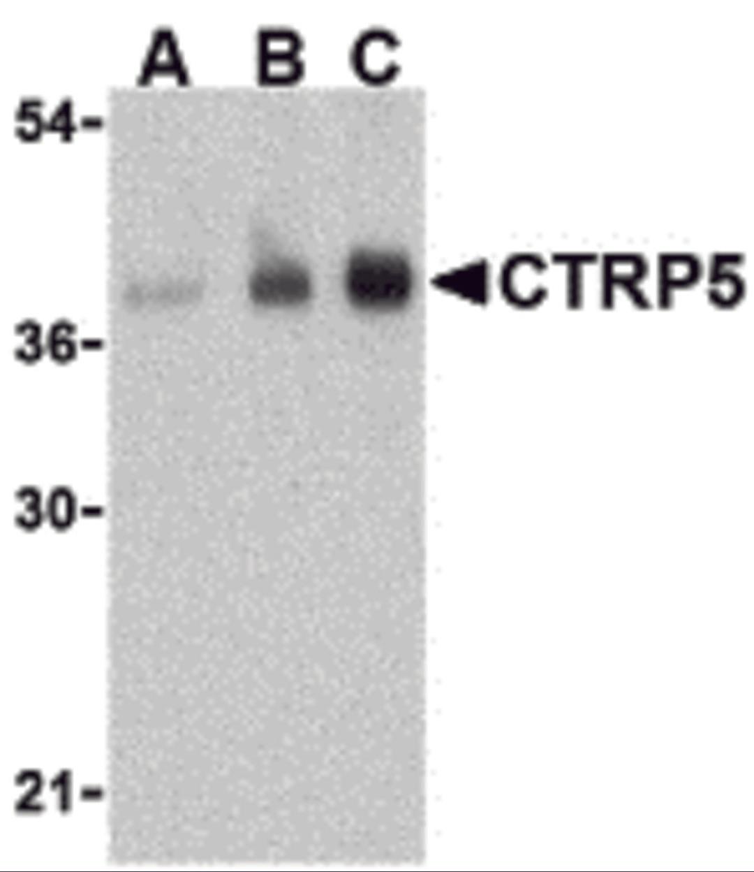 Western blot analysis of CTRP5 in human brain cell lysate with CTRP5 antibody at (A) 1, (B) 2, and (C) 4 &#956;g/mL.