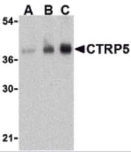 Western blot analysis of CTRP5 in human brain cell lysate with CTRP5 antibody at (A) 1, (B) 2, and (C) 4 &#956;g/mL.