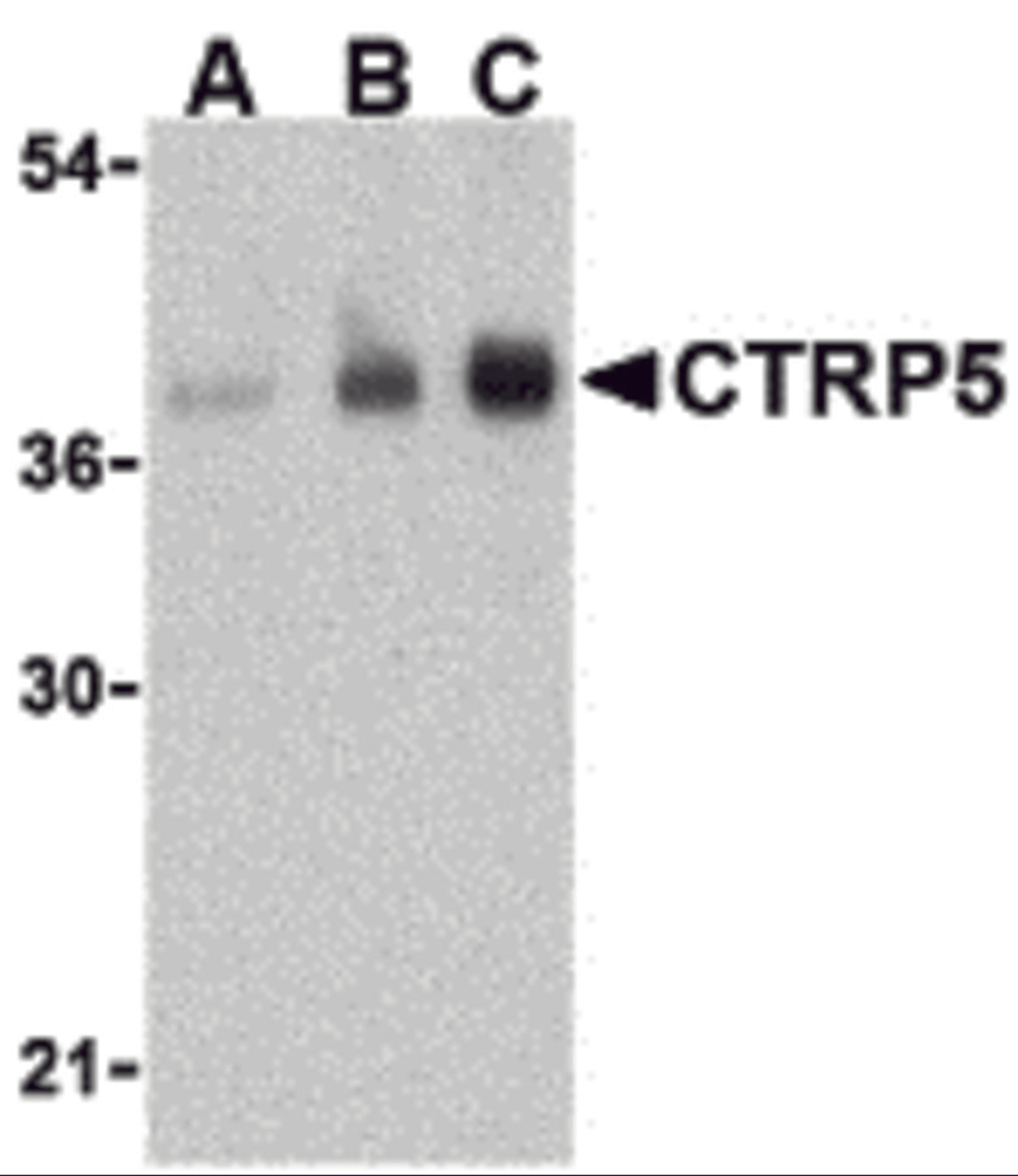 Western blot analysis of CTRP5 in human brain cell lysate with CTRP5 antibody at (A) 1, (B) 2, and (C) 4 &#956;g/mL.