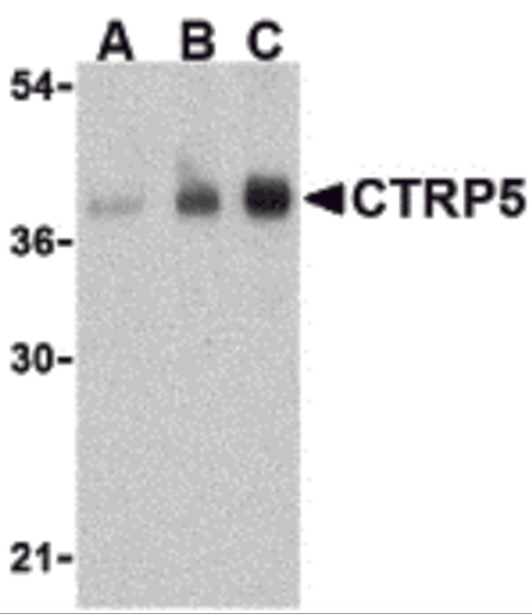 Western blot analysis of CTRP5 in human brain cell lysate with CTRP5 antibody at (A) 1, (B) 2, and (C) 4 μg/mL.