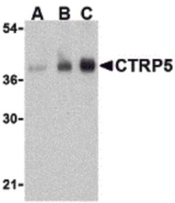 Western blot analysis of CTRP5 in human brain cell lysate with CTRP5 antibody at (A) 1, (B) 2, and (C) 4 μg/mL.