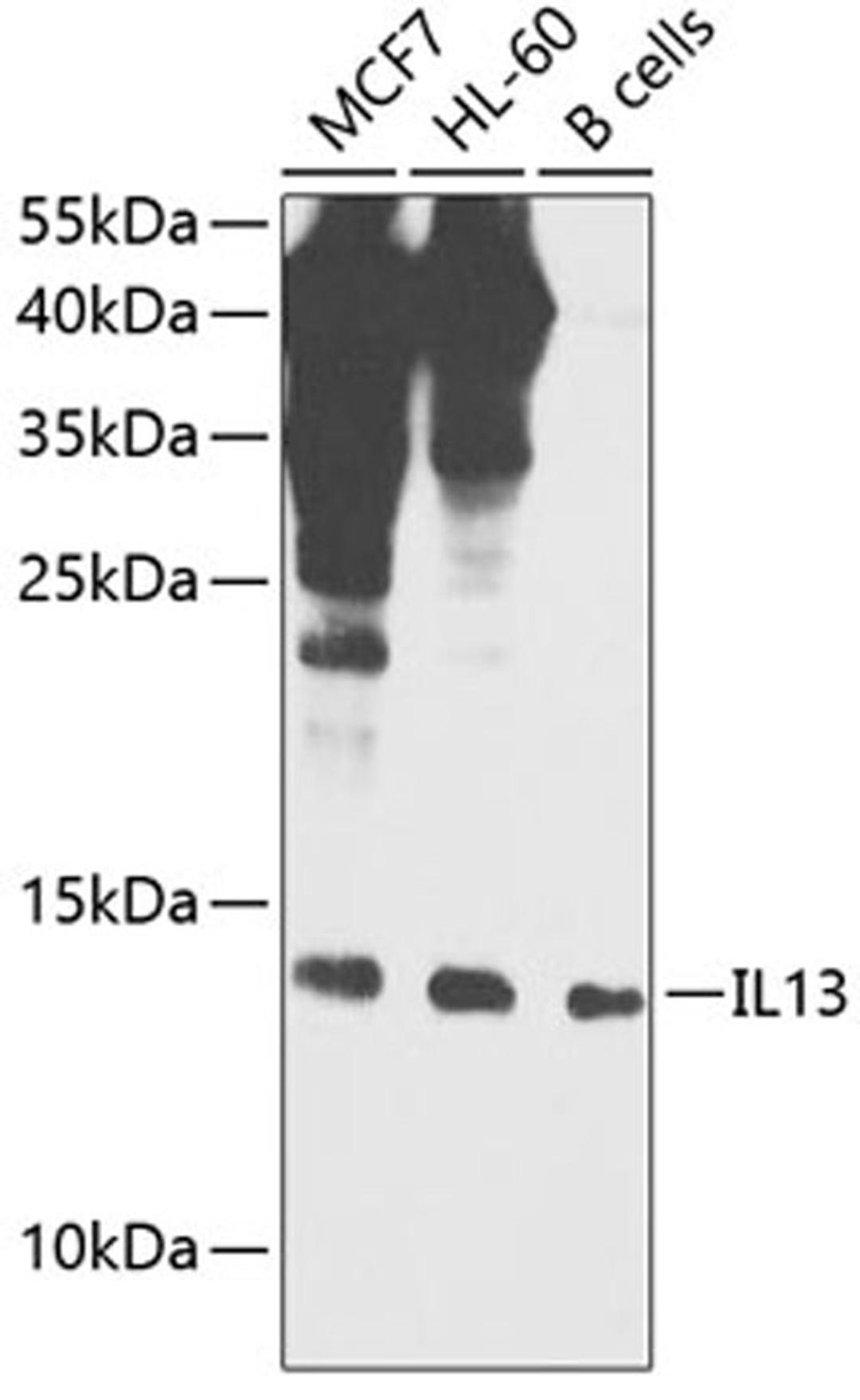 Western blot - IL13 antibody (A12453)