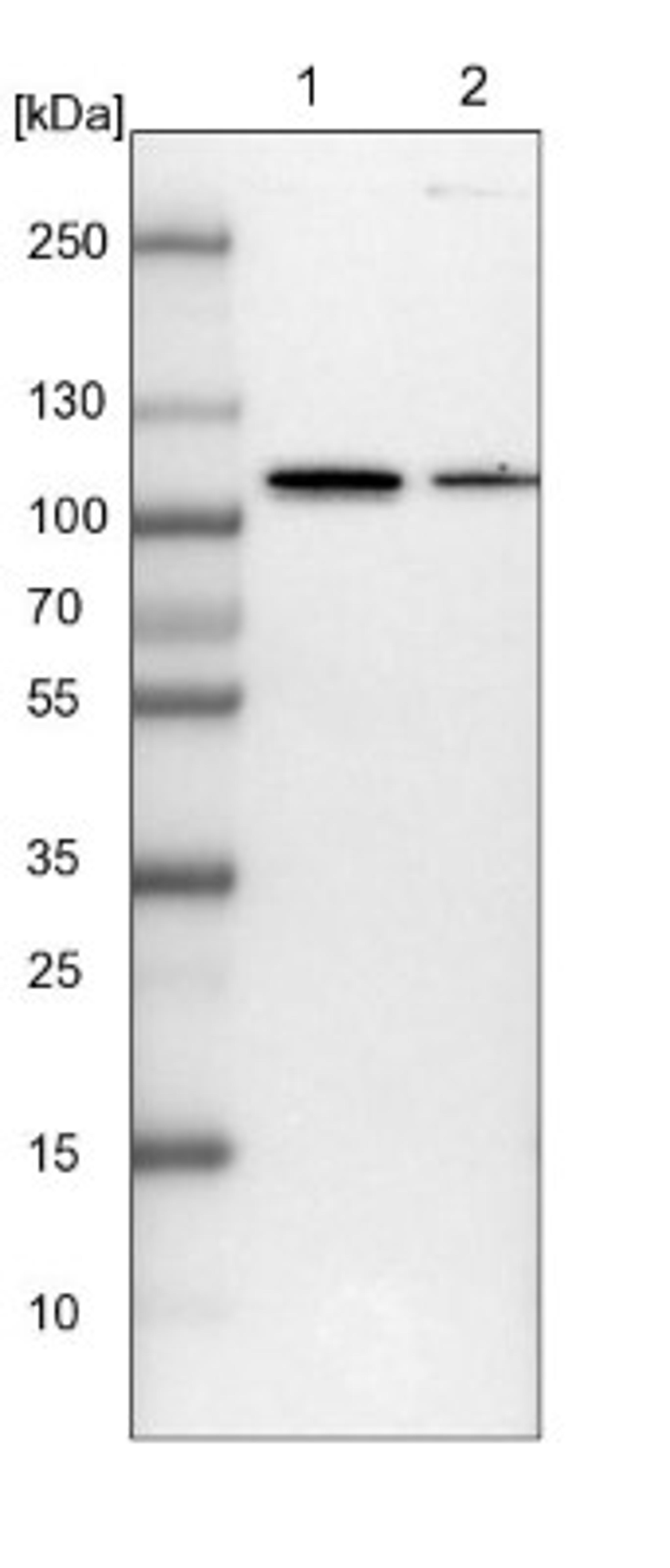 Western Blot: TBCK Antibody [NBP1-83166] - Lane 1: NIH-3T3 cell lysate (Mouse embryonic fibroblast cells)<br/>Lane 2: NBT-II cell lysate (Rat Wistar bladder tumour cells)