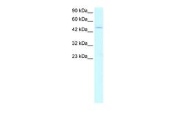 Antibody used in WB on Human Jurkat 2.5 ug/ml.