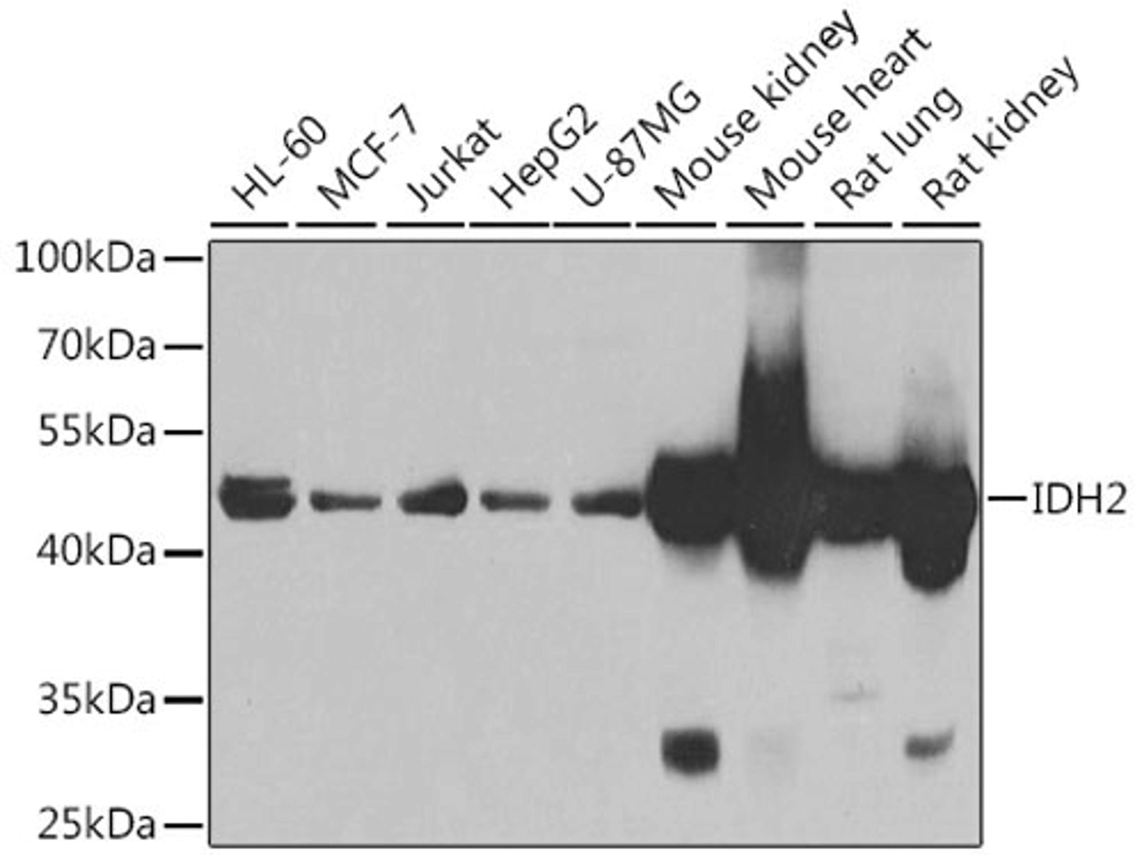 Western blot - IDH2 antibody (A7190)