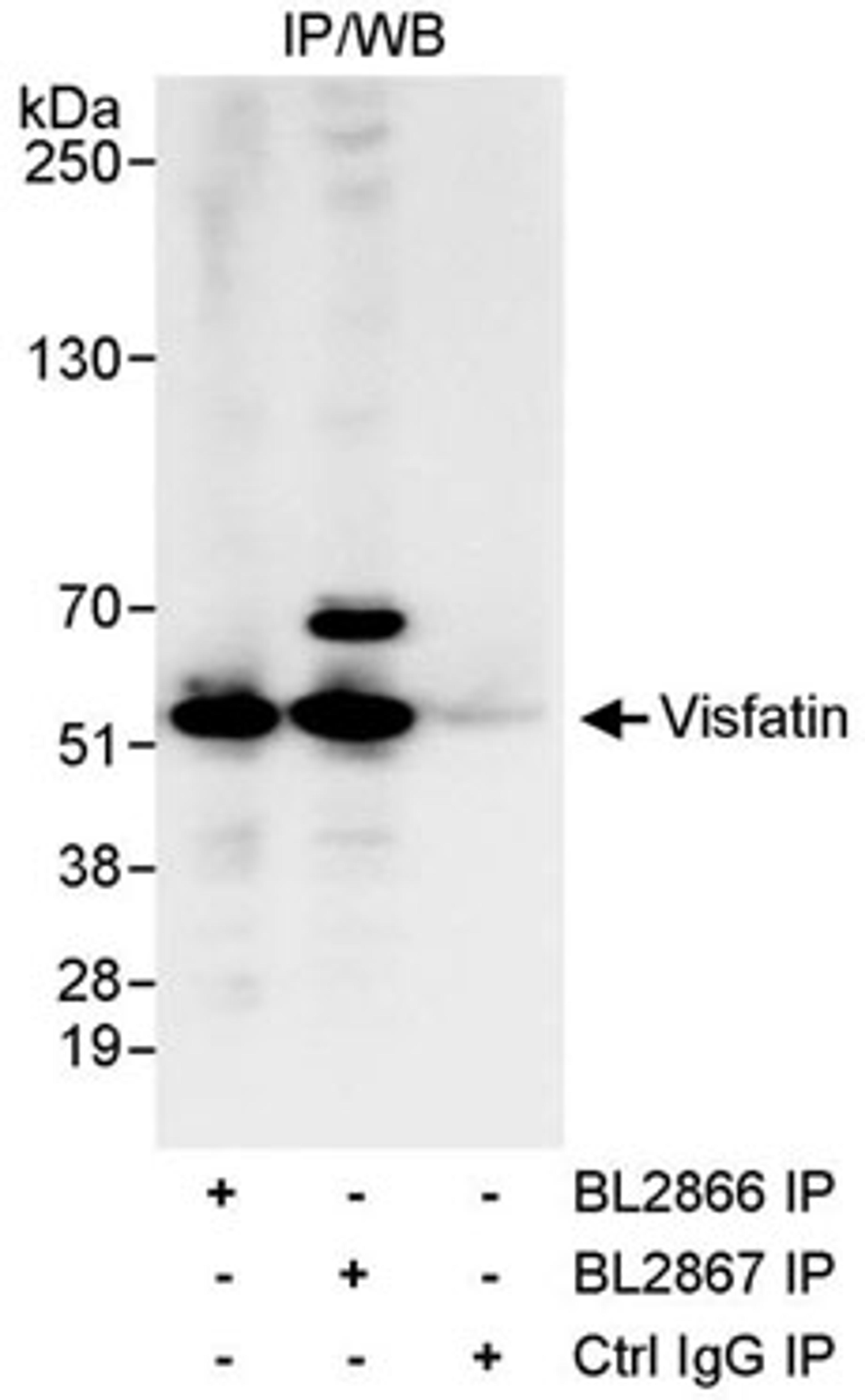 Detection of human Visfatin by western blot of immunoprecipitates.