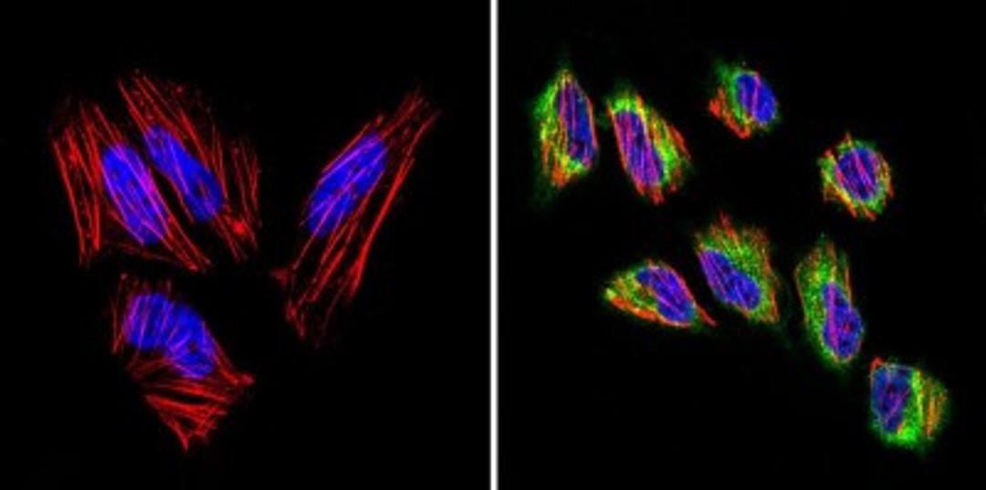 Immunocytochemistry/Immunofluorescence: VDAC3 Antibody [NB100-74561] - Analysis of VDAC3 (green) in Hela cells. Formalin-fixed cells were permeabilized with 0.1% Triton X-100 in TBS for 5-10 minutes at room temperature and blocked with 3% BSA-PBS for 30 minutes at room temperature. Cells were probed with a VDAC3 polyclonal antibody at a dilution of 1:20 and incubated overnight in a humidified chamber. Cells were washed with PBST and incubated with a DyLight-conjugated secondary antibody for 45 minutes at room temperature in the dark. F-actin (red) was stained with a fluorescent phalloidin and nuclei (blue) were stained with DAPI.