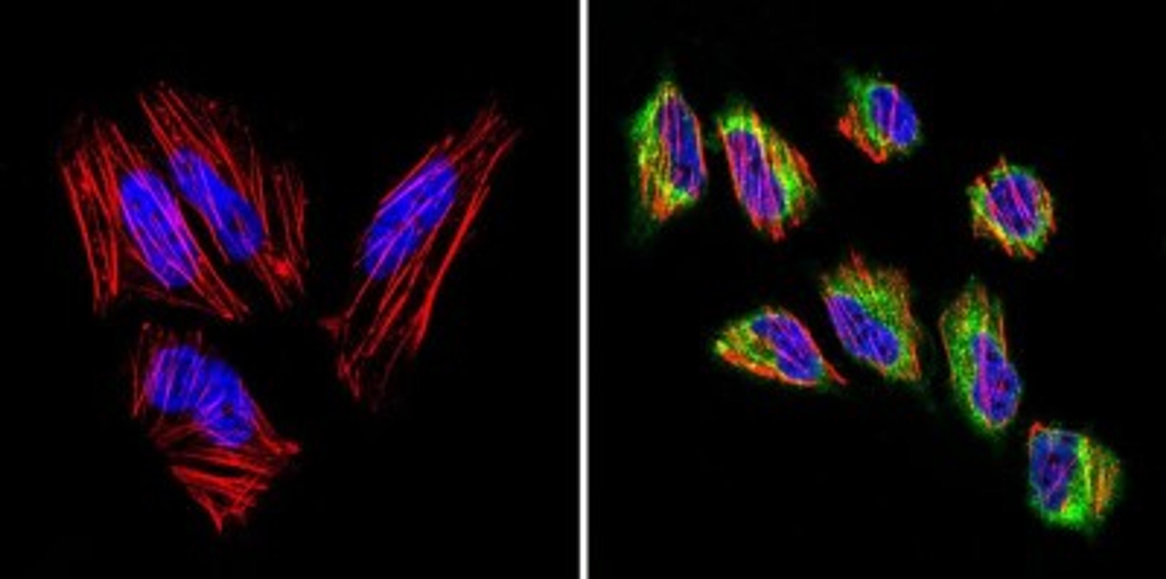 Immunocytochemistry/Immunofluorescence: VDAC3 Antibody [NB100-74561] - Analysis of VDAC3 (green) in Hela cells. Formalin-fixed cells were permeabilized with 0.1% Triton X-100 in TBS for 5-10 minutes at room temperature and blocked with 3% BSA-PBS for 30 minutes at room temperature. Cells were probed with a VDAC3 polyclonal antibody at a dilution of 1:20 and incubated overnight in a humidified chamber. Cells were washed with PBST and incubated with a DyLight-conjugated secondary antibody for 45 minutes at room temperature in the dark. F-actin (red) was stained with a fluorescent phalloidin and nuclei (blue) were stained with DAPI.