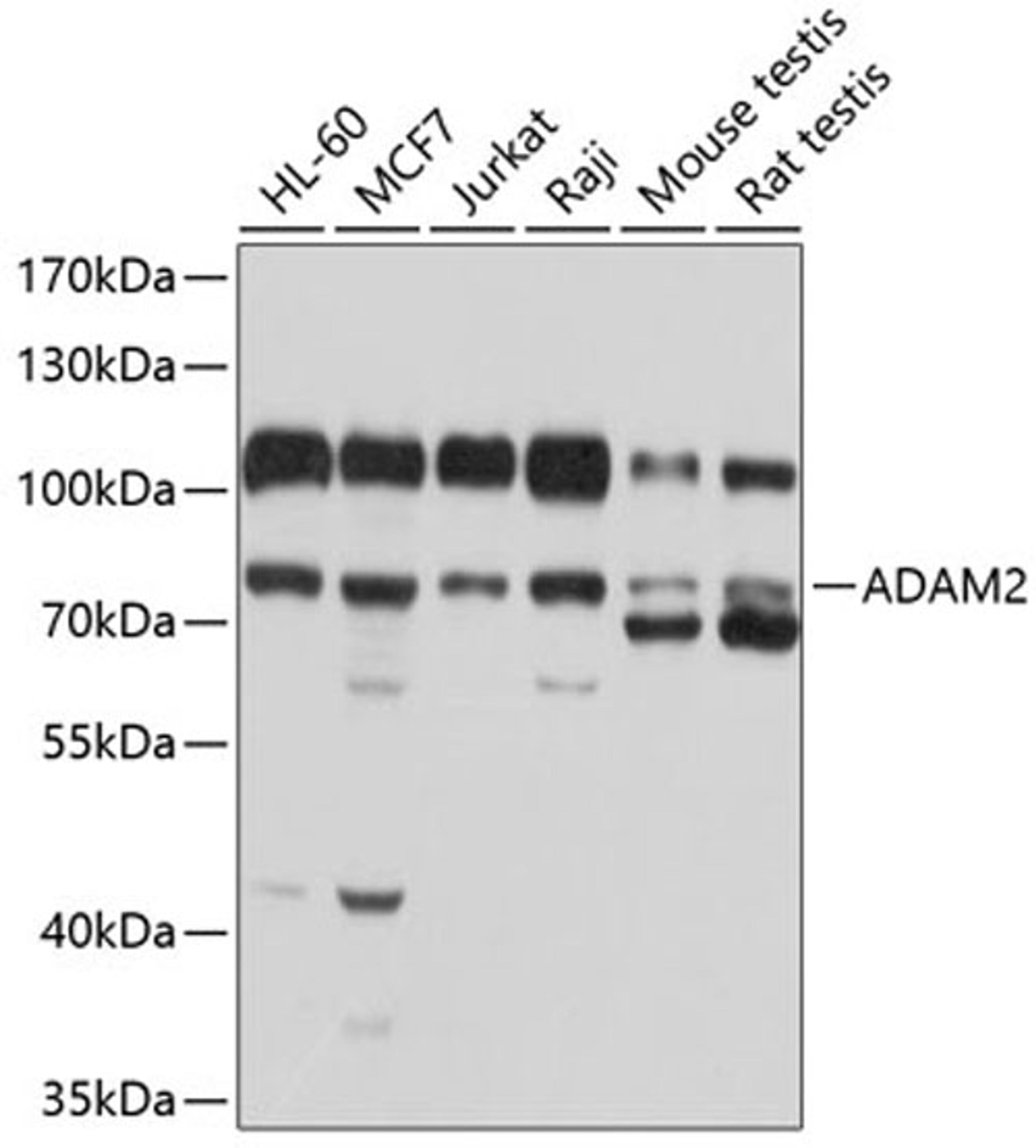 Western blot - ADAM2 antibody (A10188)