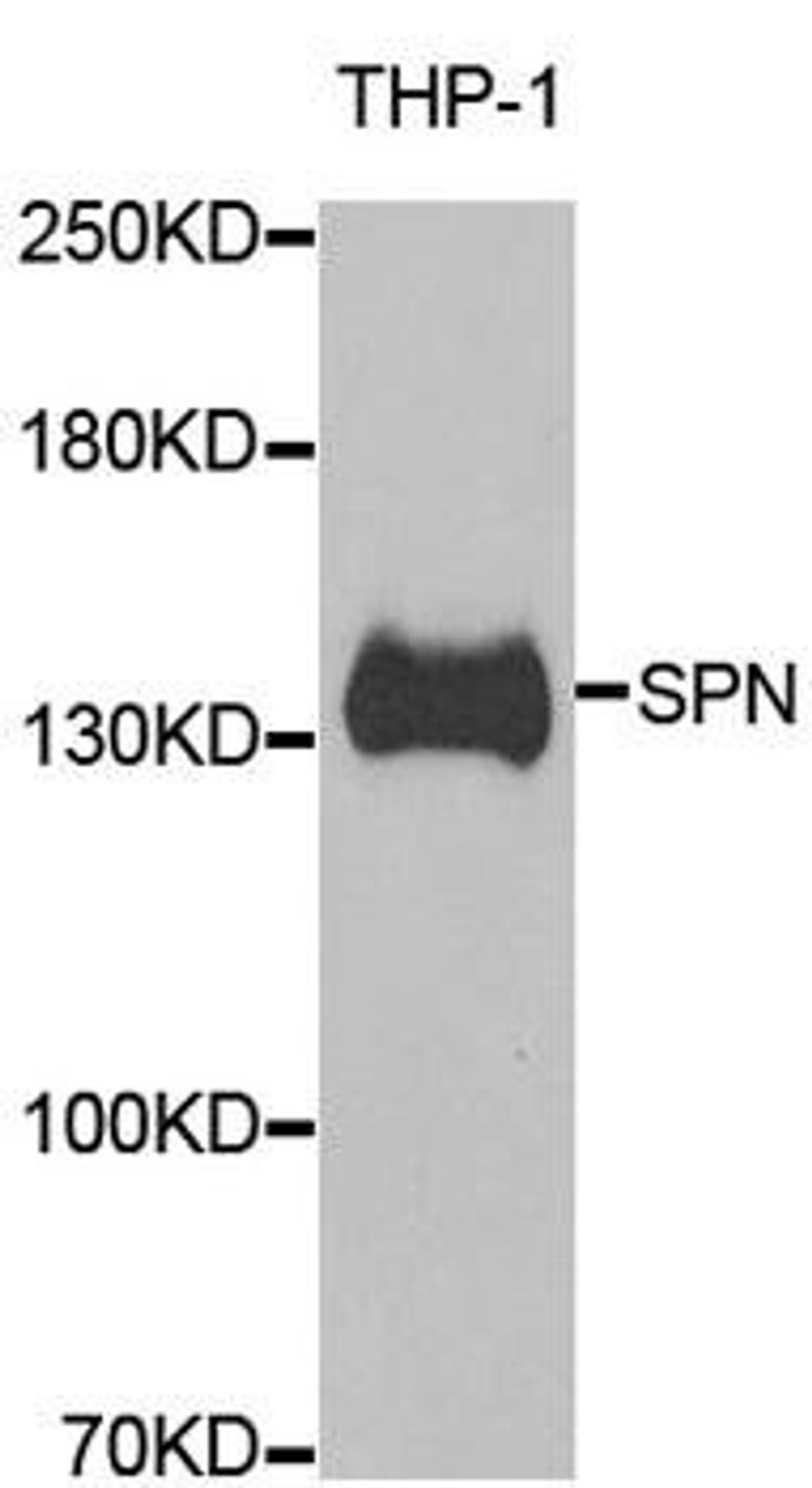 Western blot analysis of extracts of THP-1 cell line using SPN antibody