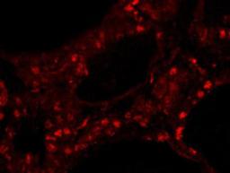 Detection of human ZNF318/TZF by IHC-IF.