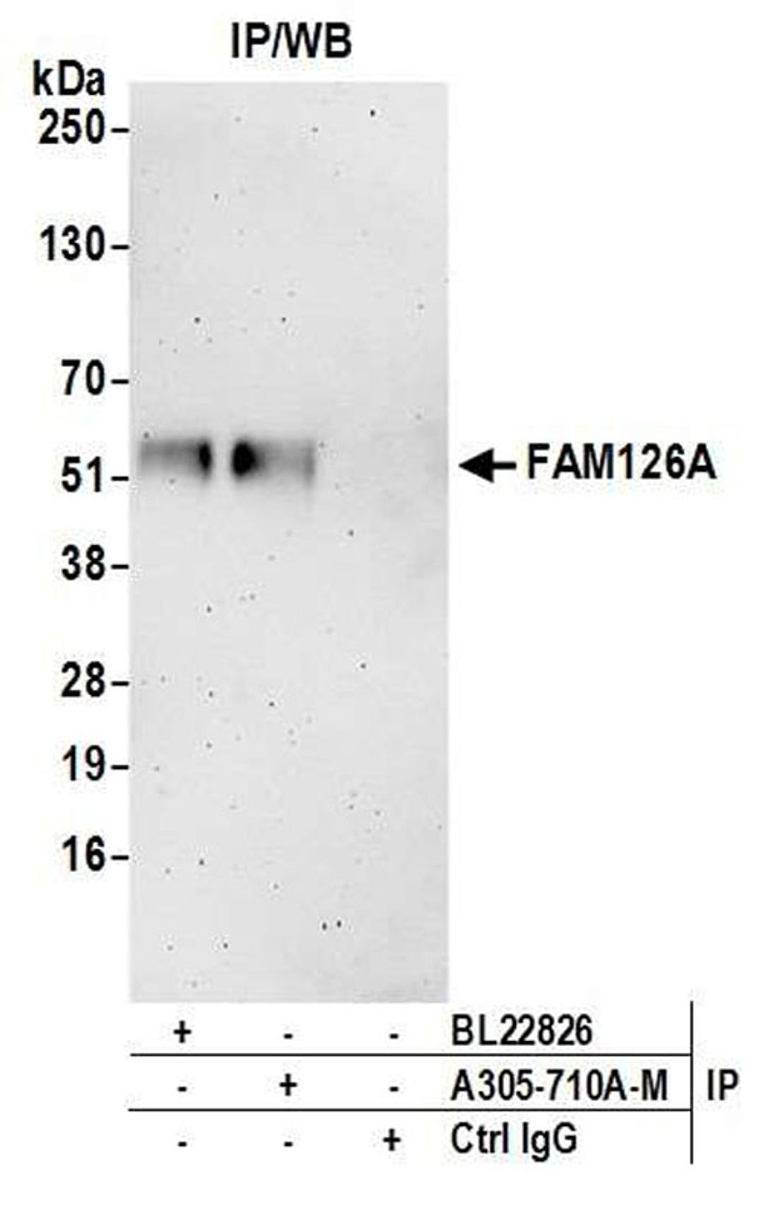 Detection of human FAM126A by WB of IP.