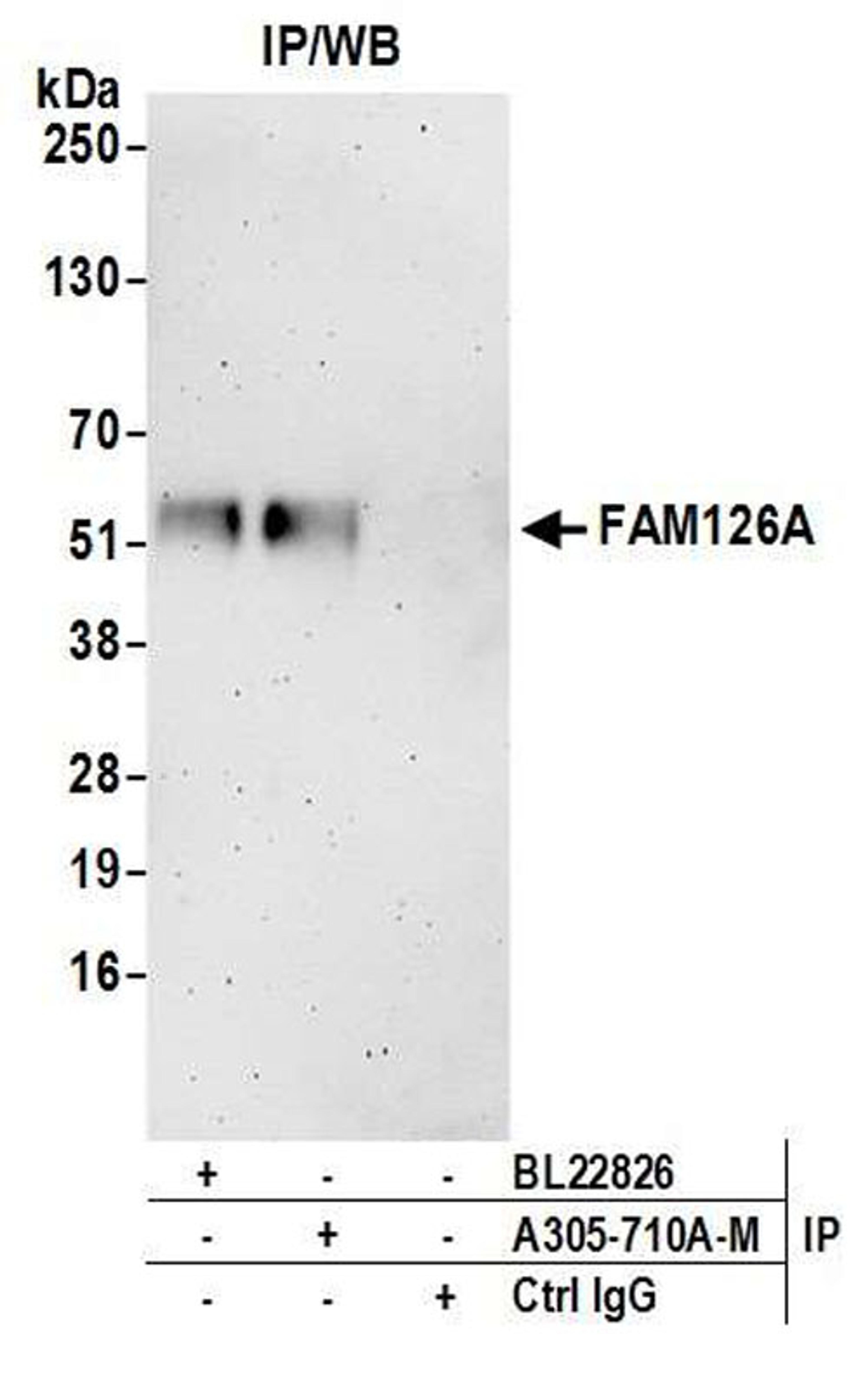 Detection of human FAM126A by WB of IP.