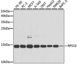 Western blot - RPS19 antibody (A2019)