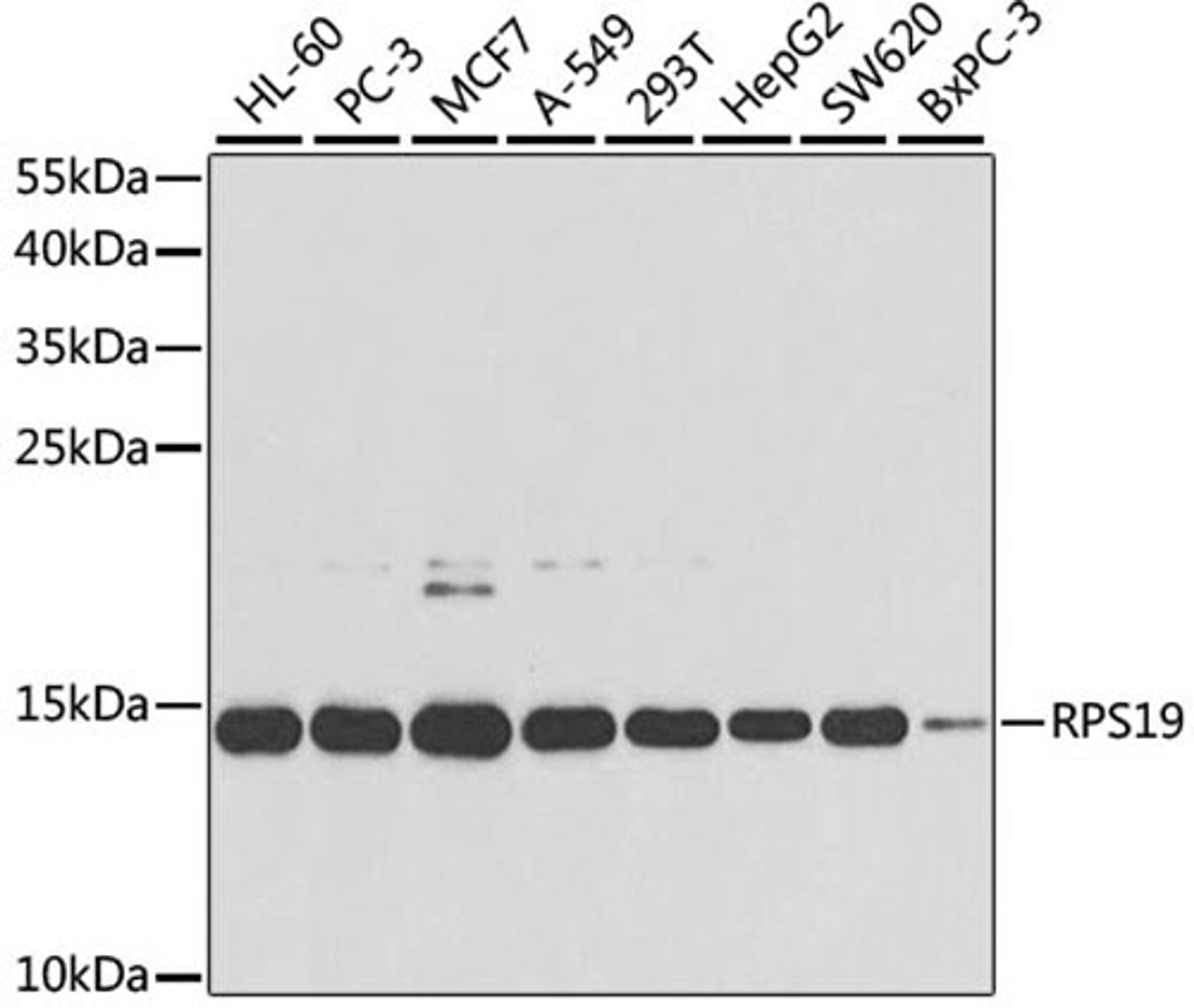 Western blot - RPS19 antibody (A2019)