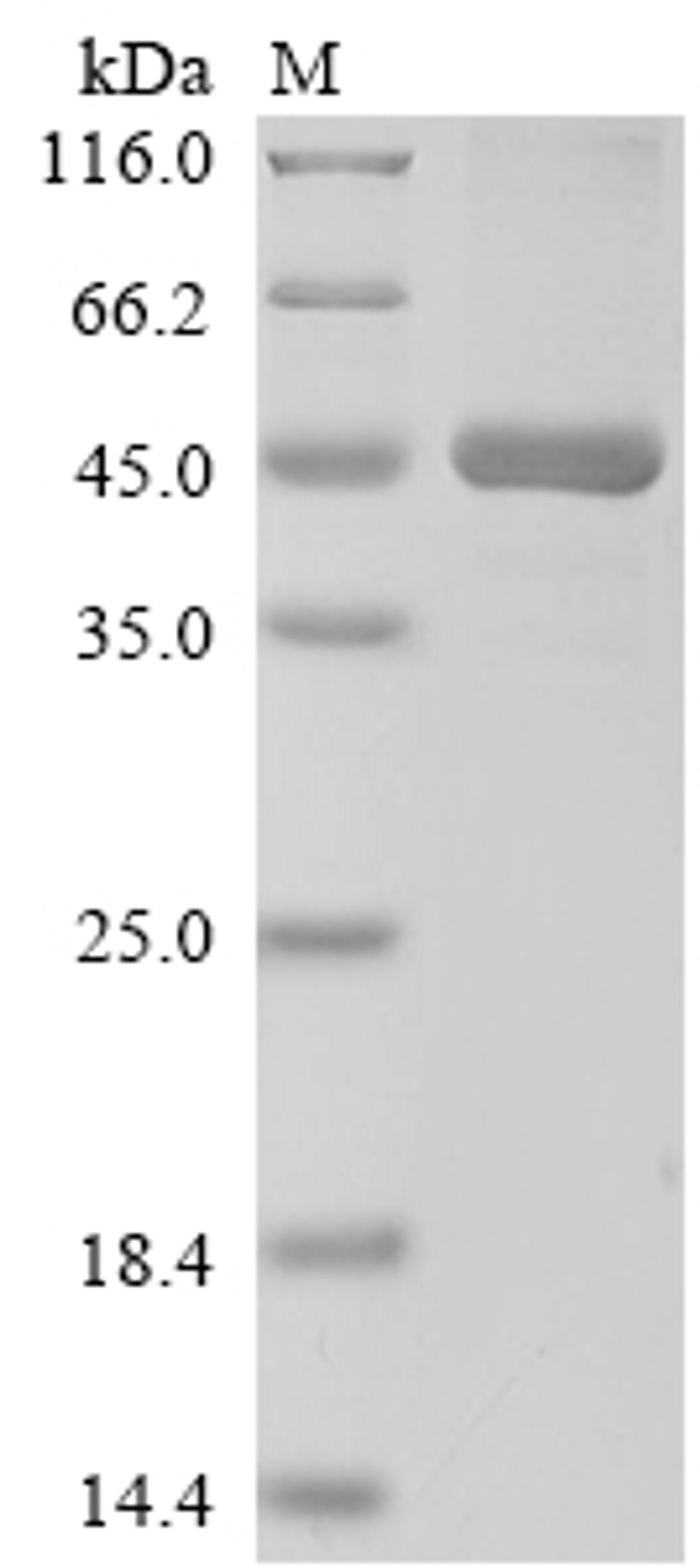 (Tris-Glycine gel) Discontinuous SDS-PAGE (reduced) with 5% enrichment gel and 15% separation gel.