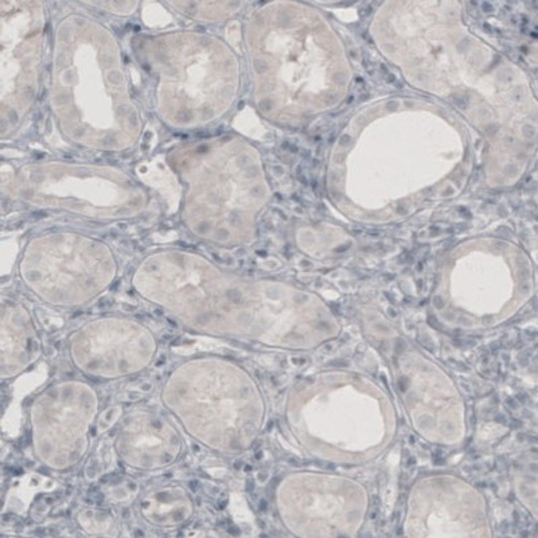 Immunohistochemistry: NET1 Antibody (3063) [NBP2-46648] - Analysis of human kidney shows absence of immunoreactivity (negative control).