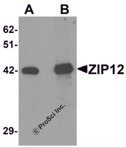 Western blot analysis of ZIP12 in HepG2 cell lysate with ZIP12 antibody at (A) 0.5 and (B) 1 &#956;g/mL.