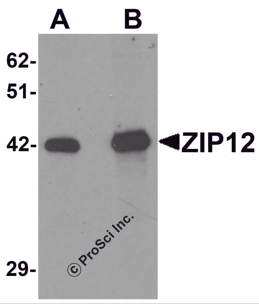 Western blot analysis of ZIP12 in HepG2 cell lysate with ZIP12 antibody at (A) 0.5 and (B) 1 μg/mL.