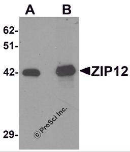 Western blot analysis of ZIP12 in HepG2 cell lysate with ZIP12 antibody at (A) 0.5 and (B) 1 μg/mL.