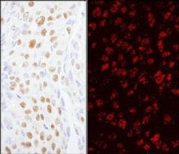 Detection of human ZCCHC8 by immunohistochemistry.