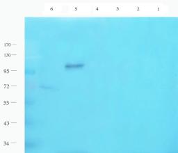 Western blot analysis of rat thyroid (lane 1), rat epididymis (lane 2), mouse ovary (lane 3), mouse testis (lane 4), mouse uterus (lane 5), mouse brain (lane 6) using LHCGR antibody (1 ug/ml)