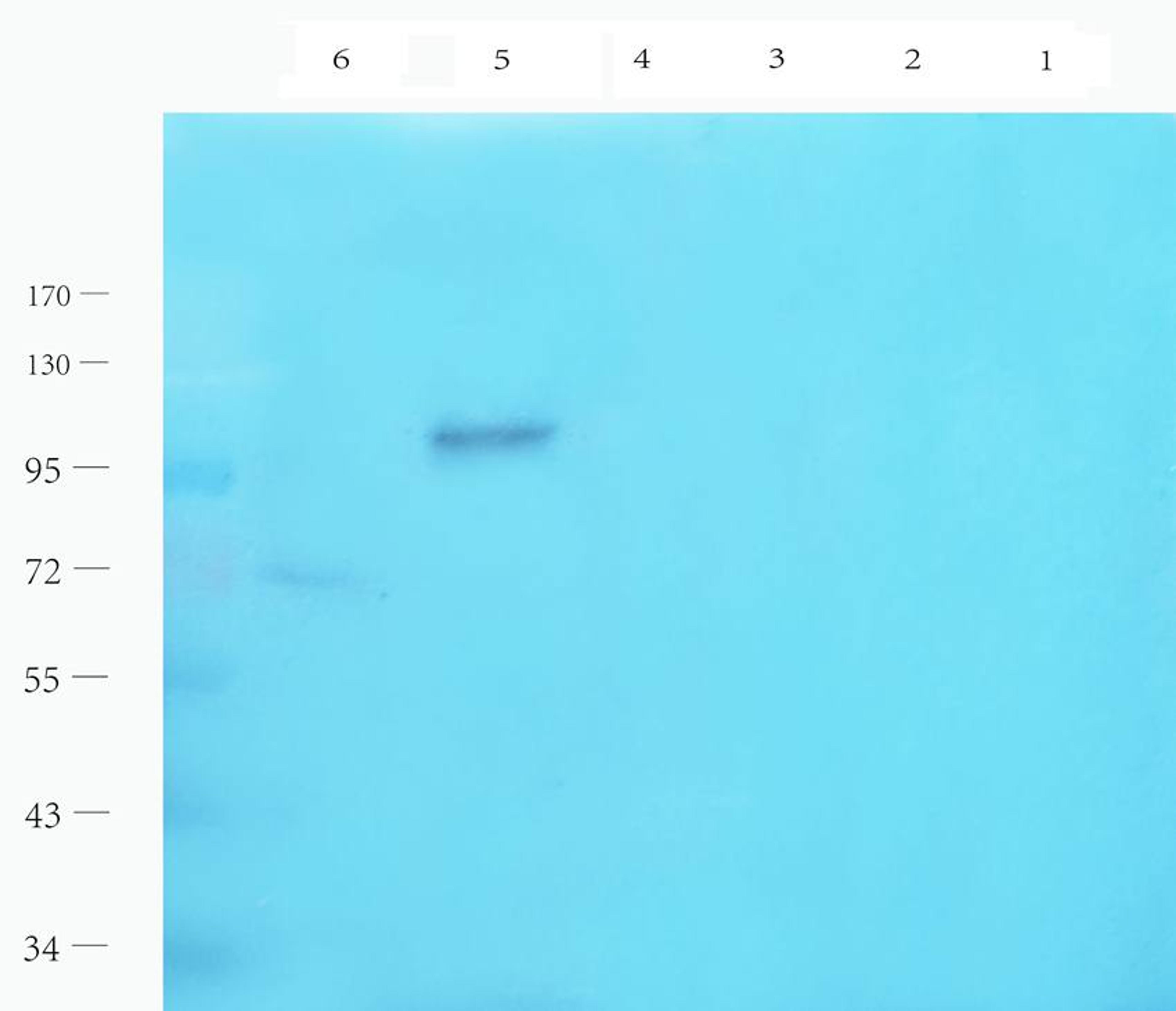 Western blot analysis of rat thyroid (lane 1), rat epididymis (lane 2), mouse ovary (lane 3), mouse testis (lane 4), mouse uterus (lane 5), mouse brain (lane 6) using LHCGR antibody (1 ug/ml)