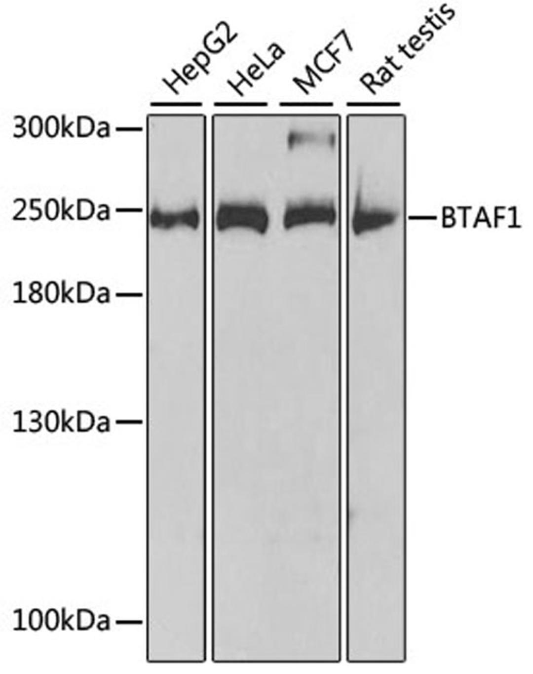 Western blot - BTAF1 antibody (A5811)